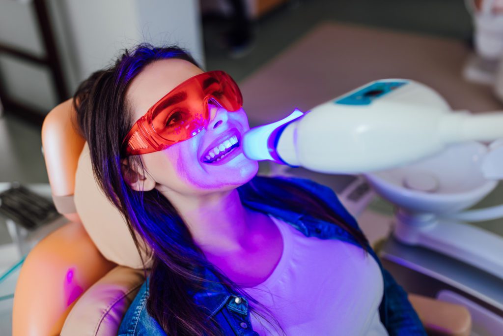 What is Teeth Whitening? Does It Work and Is It Safe | Flutter and Wink in Vancouver, Washington