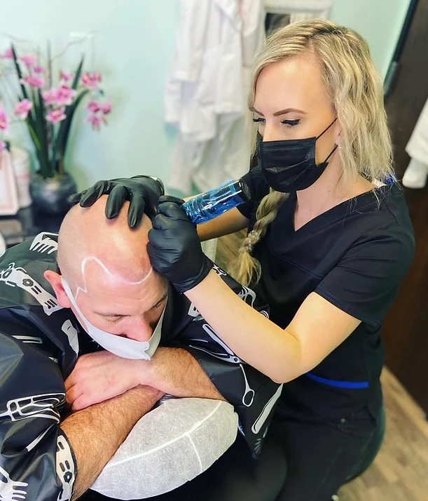 The doctor treating hair restoration for a bald guy | Get Scalp Micropigmentation (SMP) at Flutter and Wink in Vancouver, Washington