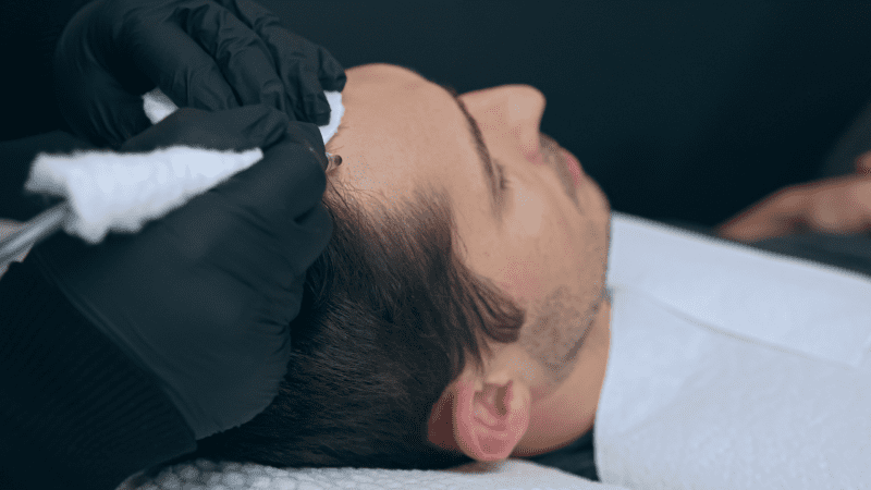 Man getting Scalp Micropigmentation for hair restoration | Flutter and Wink in Vancouver, Washington