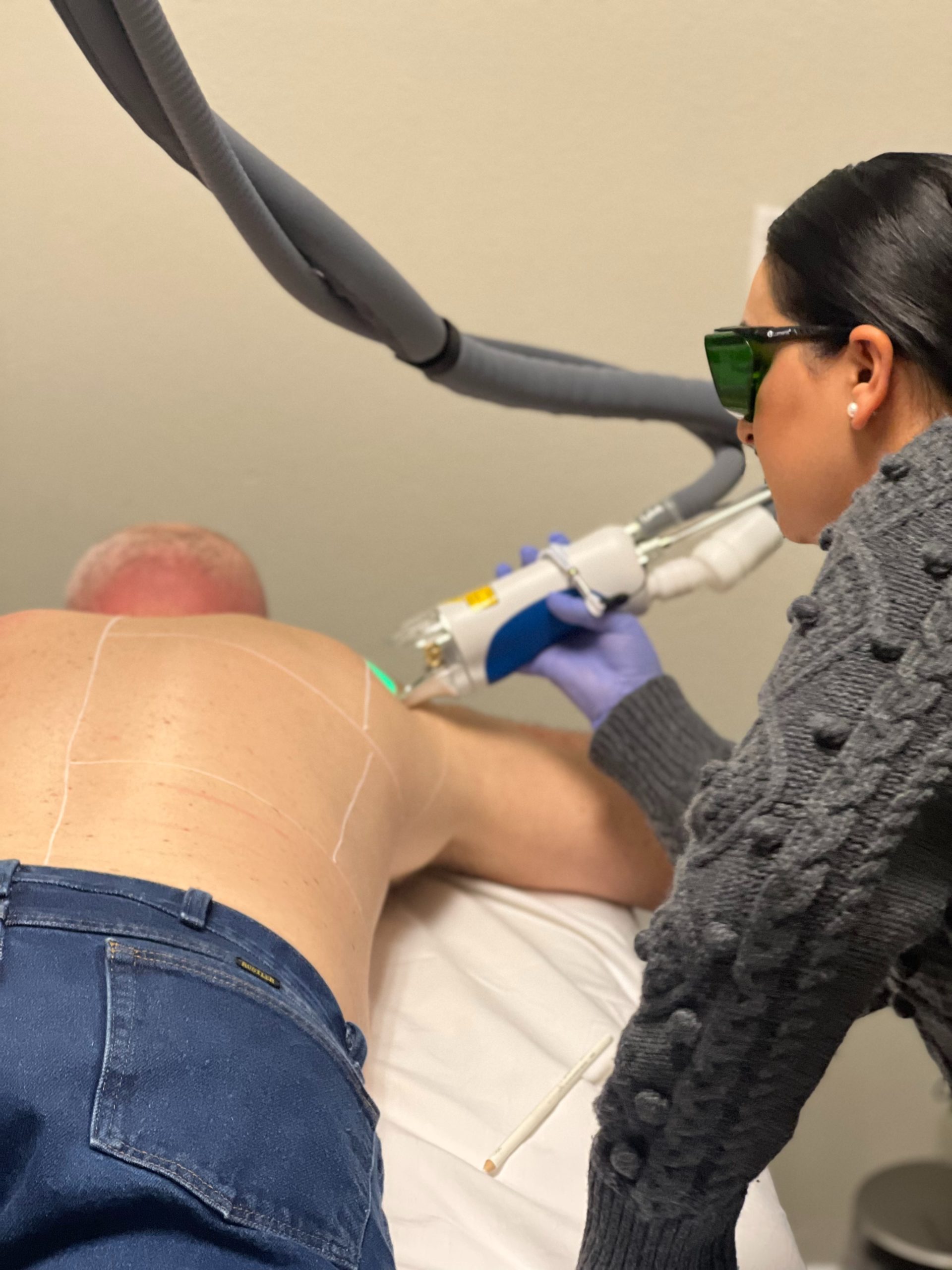 A Man taking laser hair removal by an Expert doctor at Flutter and Wink in Vancouver, Washington